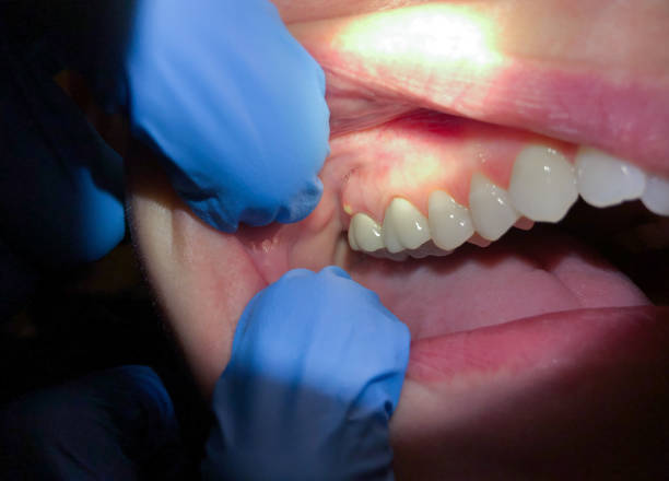Best 24-Hour Emergency Dentist  in Brodheadsville, PA