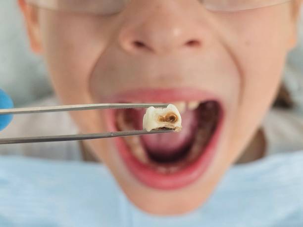 Best Urgent Tooth Repair  in Brodheadsville, PA